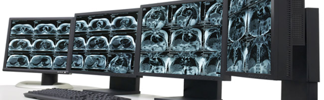 Tele Radiology 